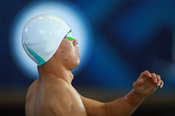 除了紅眼病，男性游泳還會感染這些你想不到的疾病